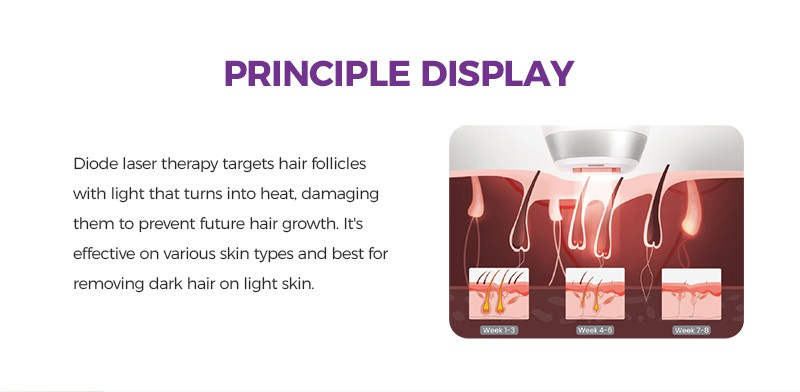 How does it effectively remove hair